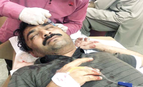 صحافی احمد نورانی نامعلوم افراد کے حملے میں زخمی
