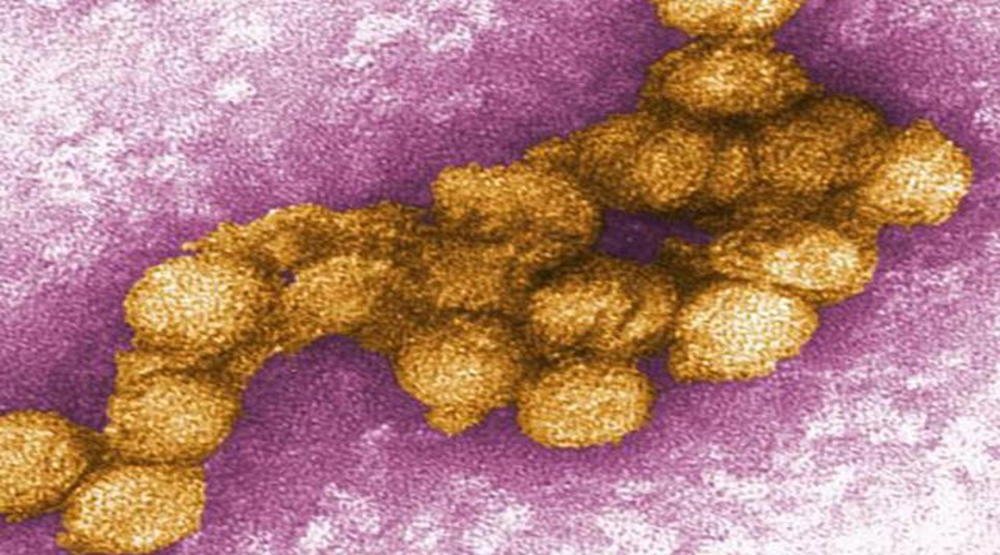 پاکستان میں ویسٹ نائل وائرس کی موجودگی کا انکشاف