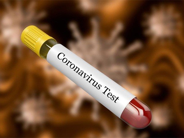 چین میں چار پاکستانی طلبہ میں کورونا وائرس کی تصدیق ہوچکی،ظفرمرزا