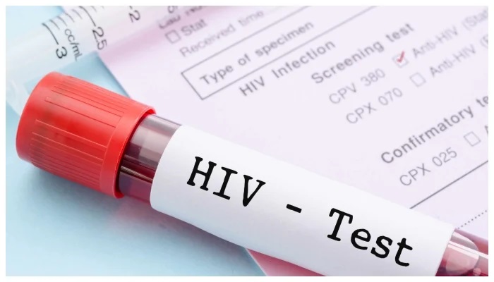 لاڑکانہ میں ایچ آئی وی کا پھیلاؤ روکنے کے لیے تیاریاں شروع
