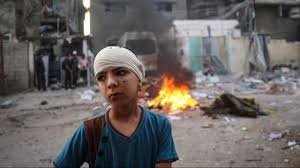 غزہ میں مسلمان بچوں کے سر اور سینے پر گولیوں کا نشانہ