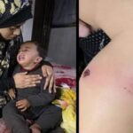 اسرائیلی فوج نے فلسطینی 18 ماہ کے بچے کو سگریٹ سے داغ دیا