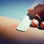 ٹی بی ٹیسٹ کٹس کی ملک بھر میں شدید قلت، تشخیصی نظام متاثر