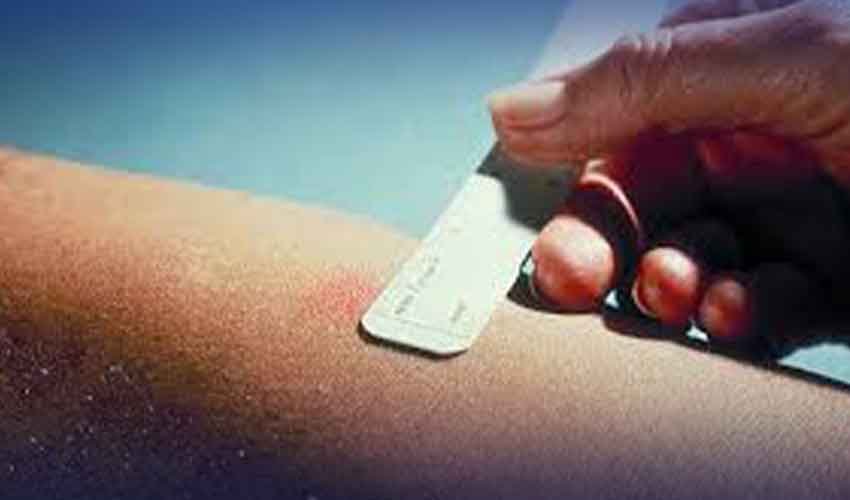 ٹی بی ٹیسٹ کٹس کی ملک بھر میں شدید قلت، تشخیصی نظام متاثر