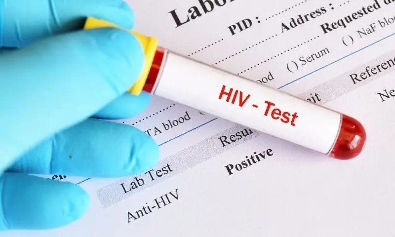 سندھ میں ایچ آئی وی کے 4 بڑے آؤٹ بریکس، سیکڑوں بچے متاثر