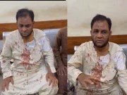 سندھ گرین ریسٹورنٹ کے مالک کے بیٹے کا جامعہ کراچی کے سنیئر پروفیسر پر تشدد
