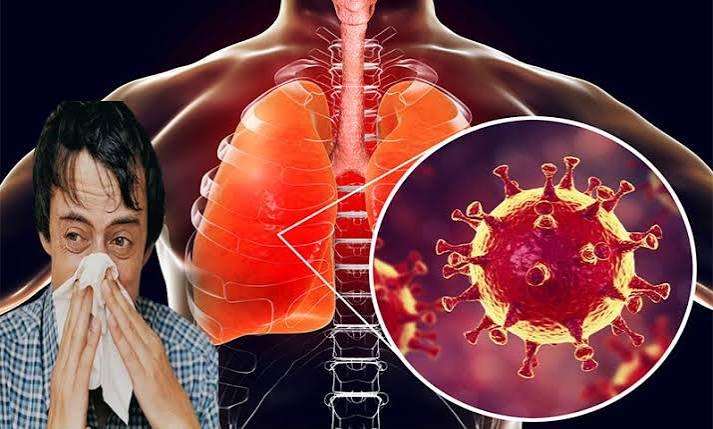کراچی میں انفلوئنزا کے کیسز میں 20 فیصد اضافہ، کورونا بھی برقرار